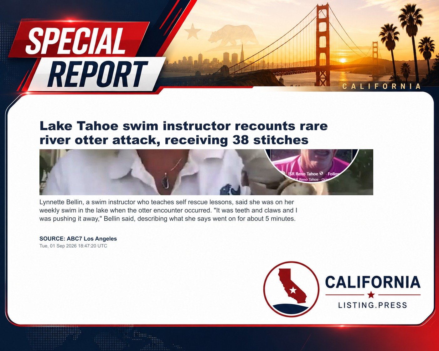Lake Tahoe swim instructor recounts rare river otter attack, receiving 38 stitches
