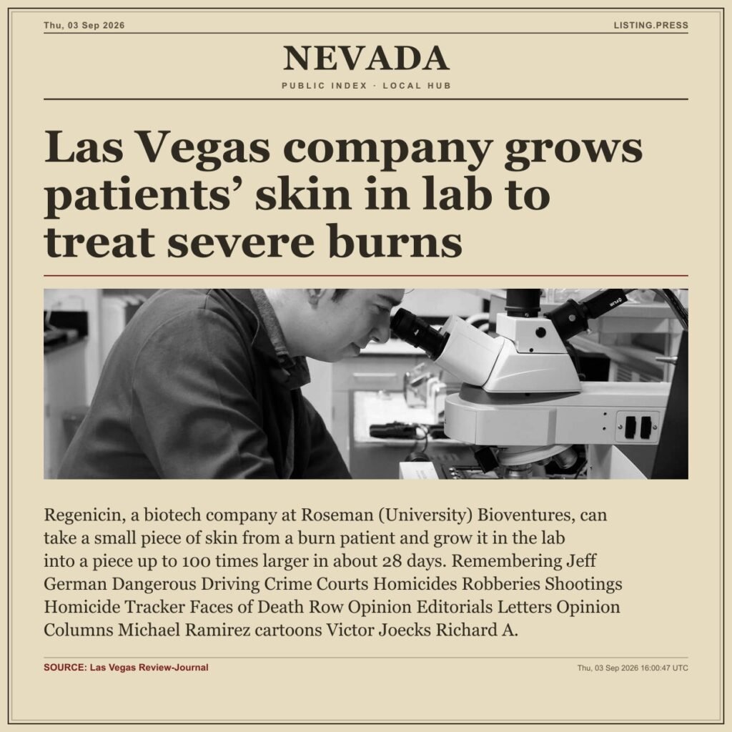 Las Vegas company grows patients’ skin in lab to treat severe burns