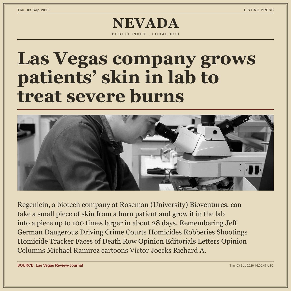 Las Vegas company grows patients’ skin in lab to treat severe burns