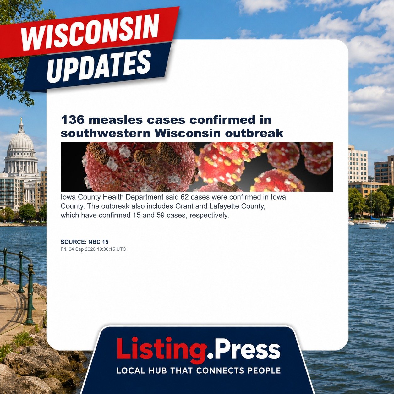 136 measles cases confirmed in southwestern Wisconsin outbreak